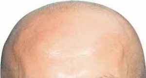 best fake tan for bald head